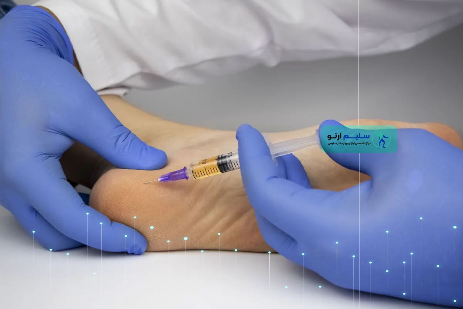 خار پاشنه چیست و راه های درمان خارپاشنه روش درمان خار پاشنه