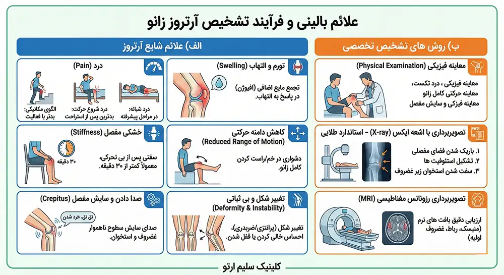 آرتروز زانو علائم بالینی و فرآیند تشخیص آرتروز زانو