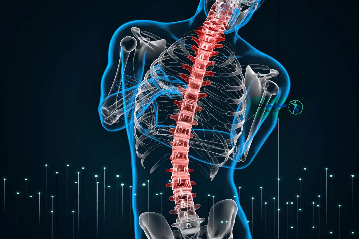 اسکولیوز یا انحراف ستون فقرات چیست و راهکارهای درمانی این بیماری علل انحراف ستون فقرات: چرا اسکولیوز رخ می دهد؟