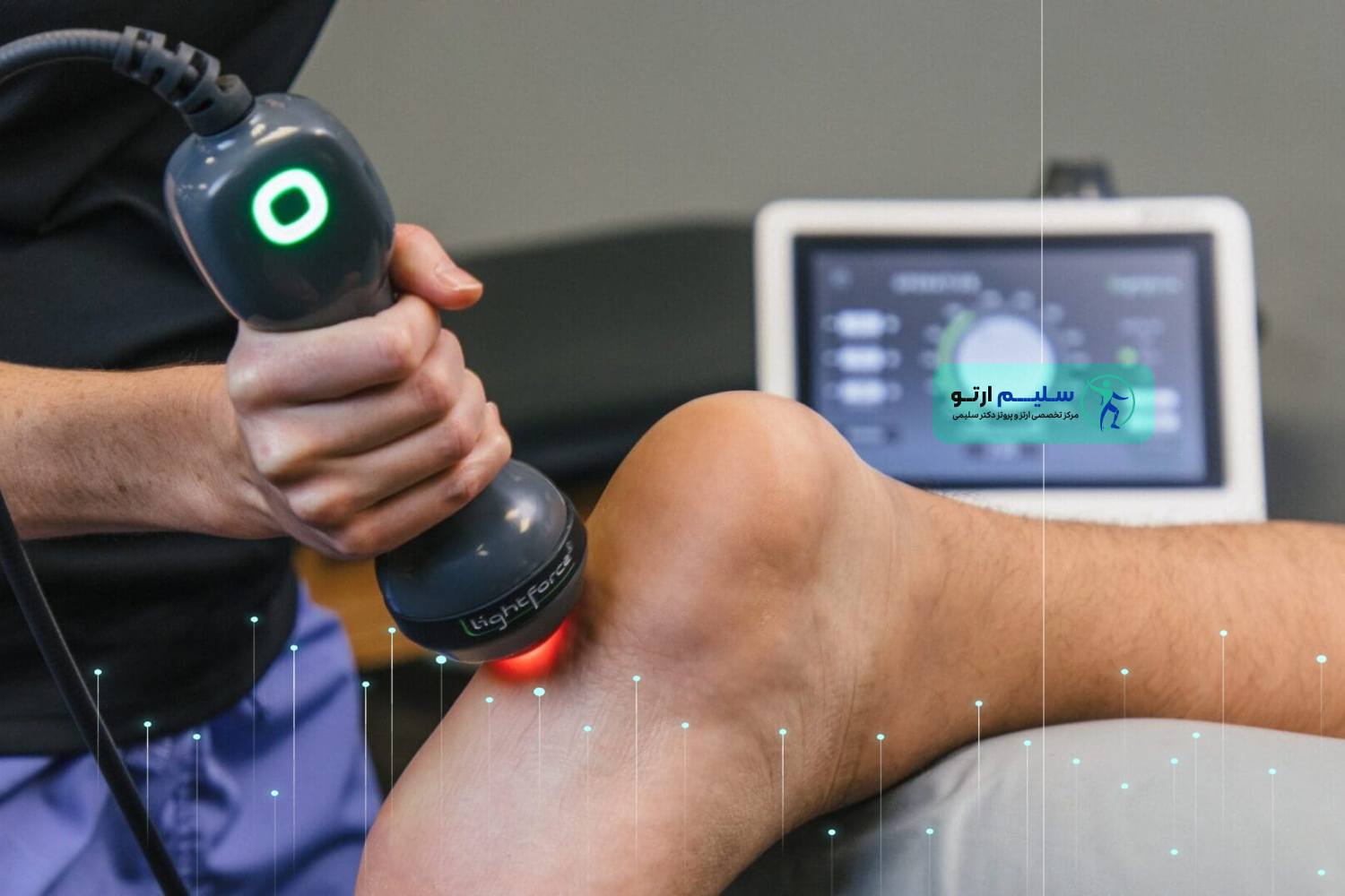 درمان خار پاشنه با لیزر کاندید مناسب درمان خار پاشنه با لیزر