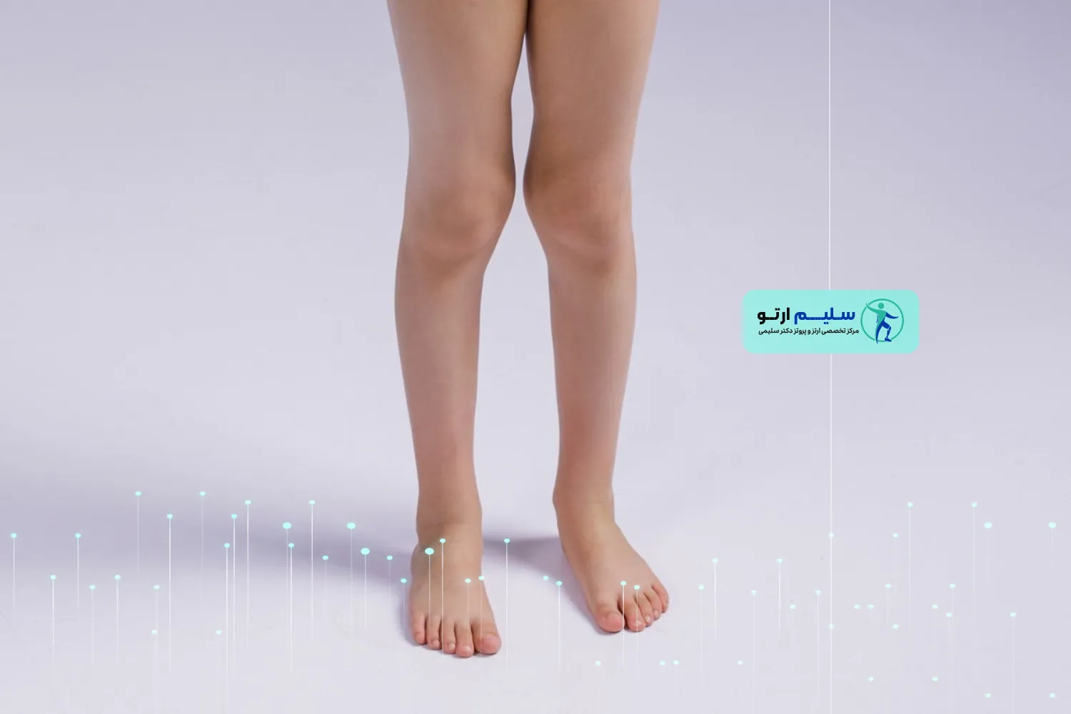 انحراف زانو درمان انحراف زانو