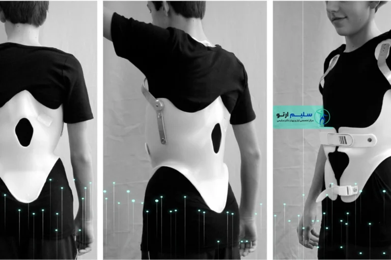 رزرو آنلاین وقت ساخت کمربند کایفولوژیک در سلیم ارتو