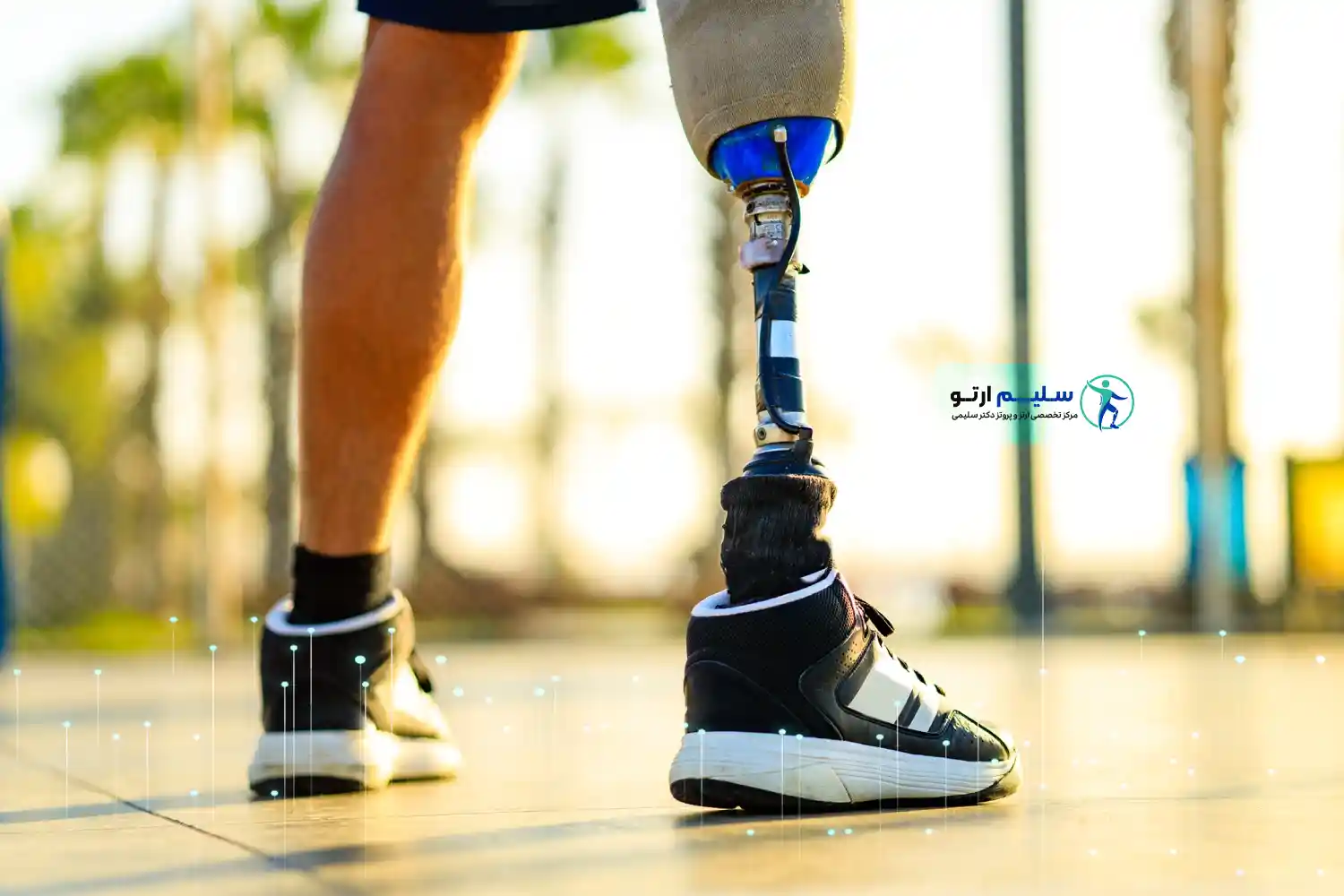 ساخت پروتز فرایند ساخت پروتز