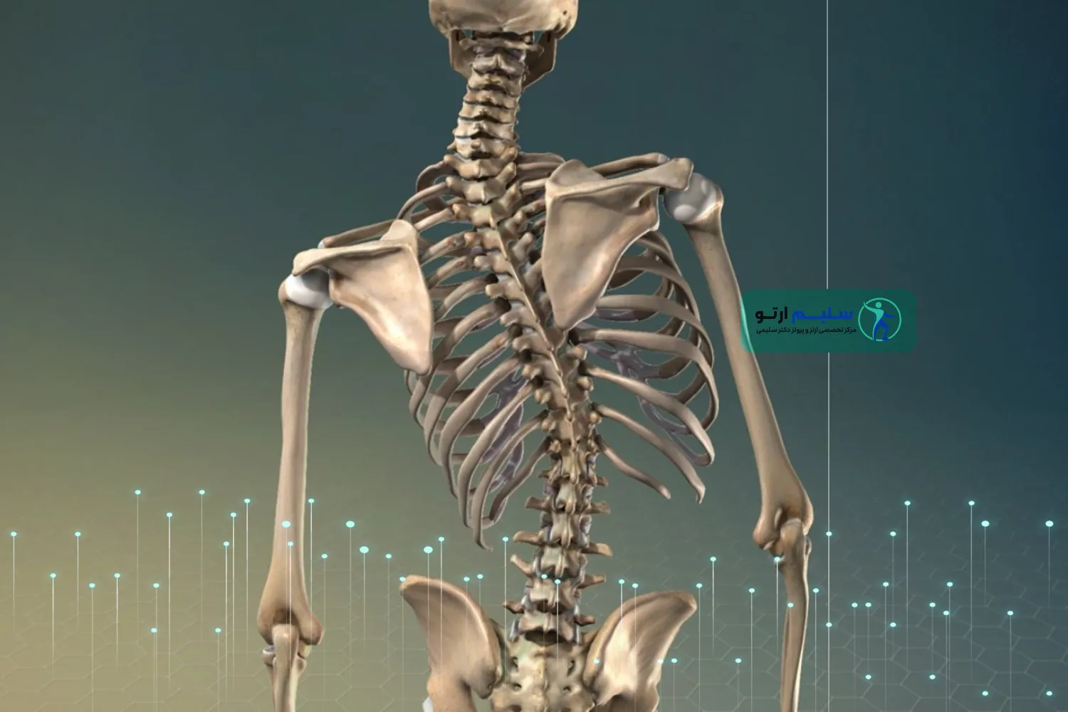 انحراف ستون فقرات انحراف ستون فقرات چیست