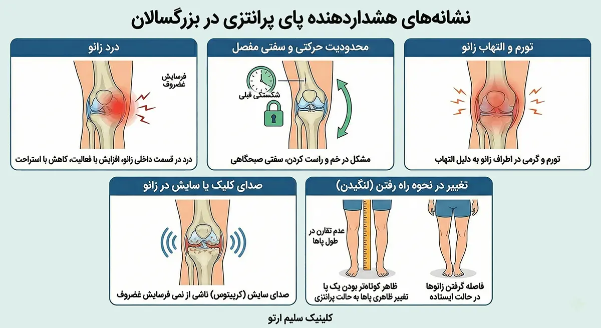 پای پرانتزی در بزرگسالان نشانه های هشداردهنده پای پرانتزی در بزرگسالان