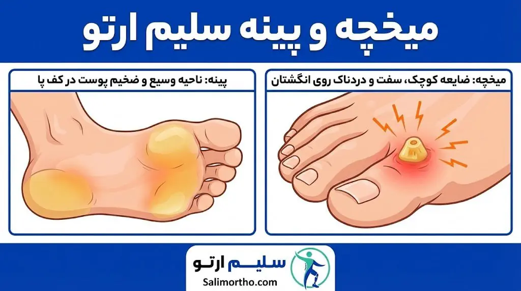 میخچه و پینه؛ علت، پیشگیری و درمان میخچه و پینه: خداحافظی با درد، سلام به راحتی با سلیم ارتو!
