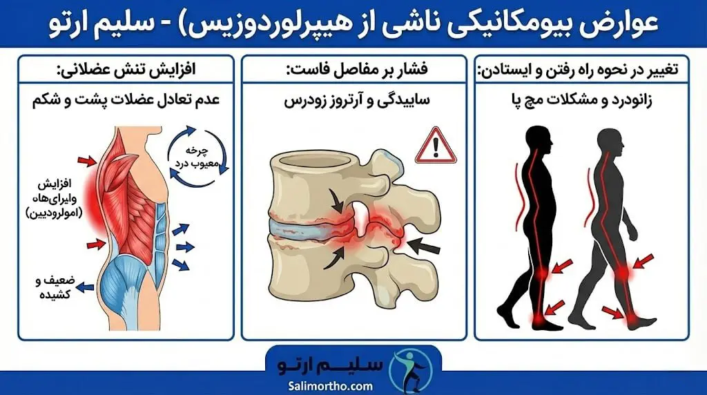 گودی کمر (لوردوز) عوارض گودی کمر