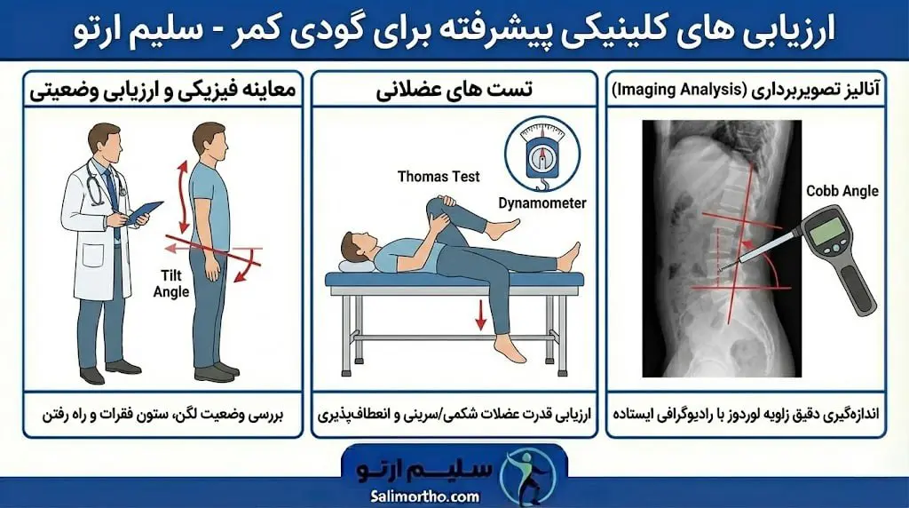 گودی کمر (لوردوز) روش های تشخیص لوردوز (گودی کمر) کلینیکی
