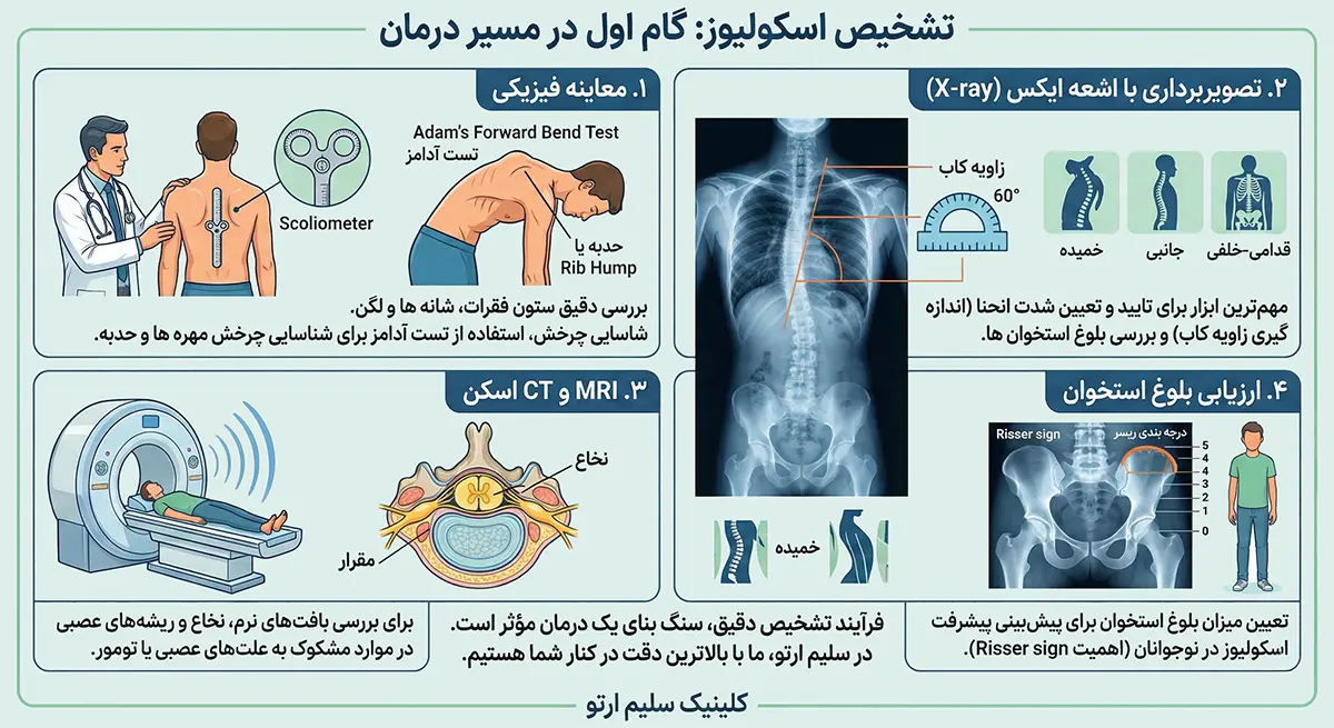 اسکولیوز یا انحراف ستون فقرات چیست و راهکارهای درمانی این بیماری تشخیص اسکولیوز: گام اول در مسیر درمان