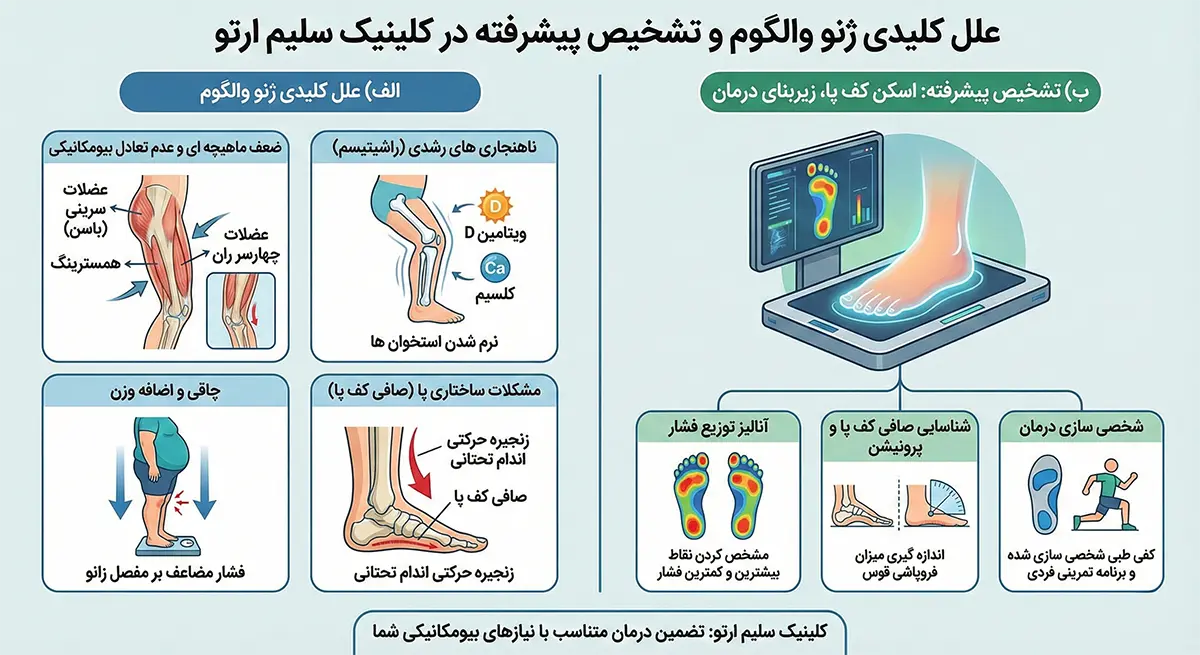 زانوی ضربدری علل اصلی زانوی ضربدری و ضرورت تشخیص تخصصی