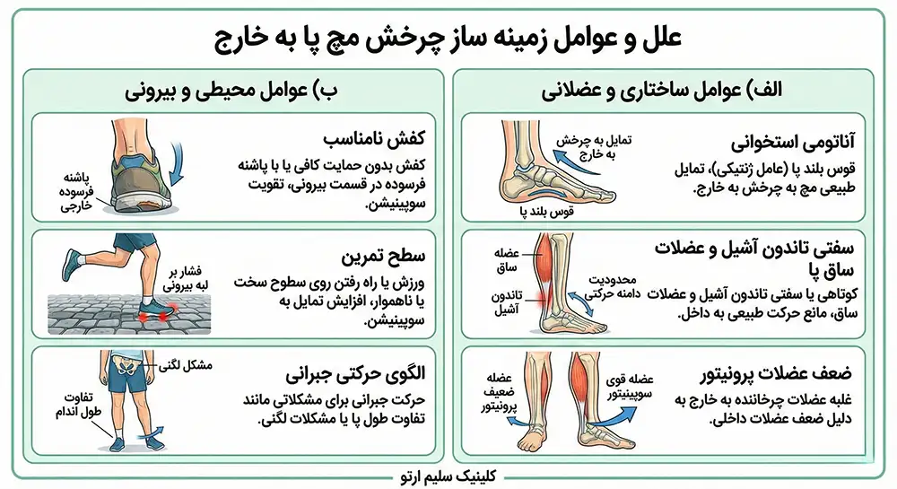 چرخش مچ پا به خارج علل و عوامل زمینه ساز چرخش مچ پا به خارج