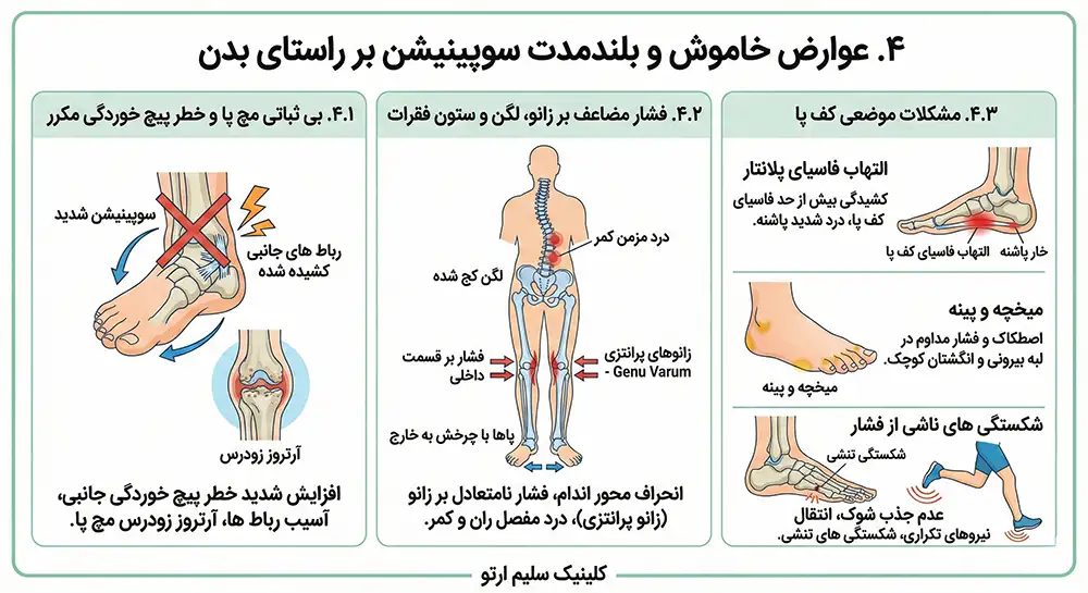 چرخش مچ پا به خارج عوارض خاموش و بلندمدت سوپینیشن بر راستای بدن