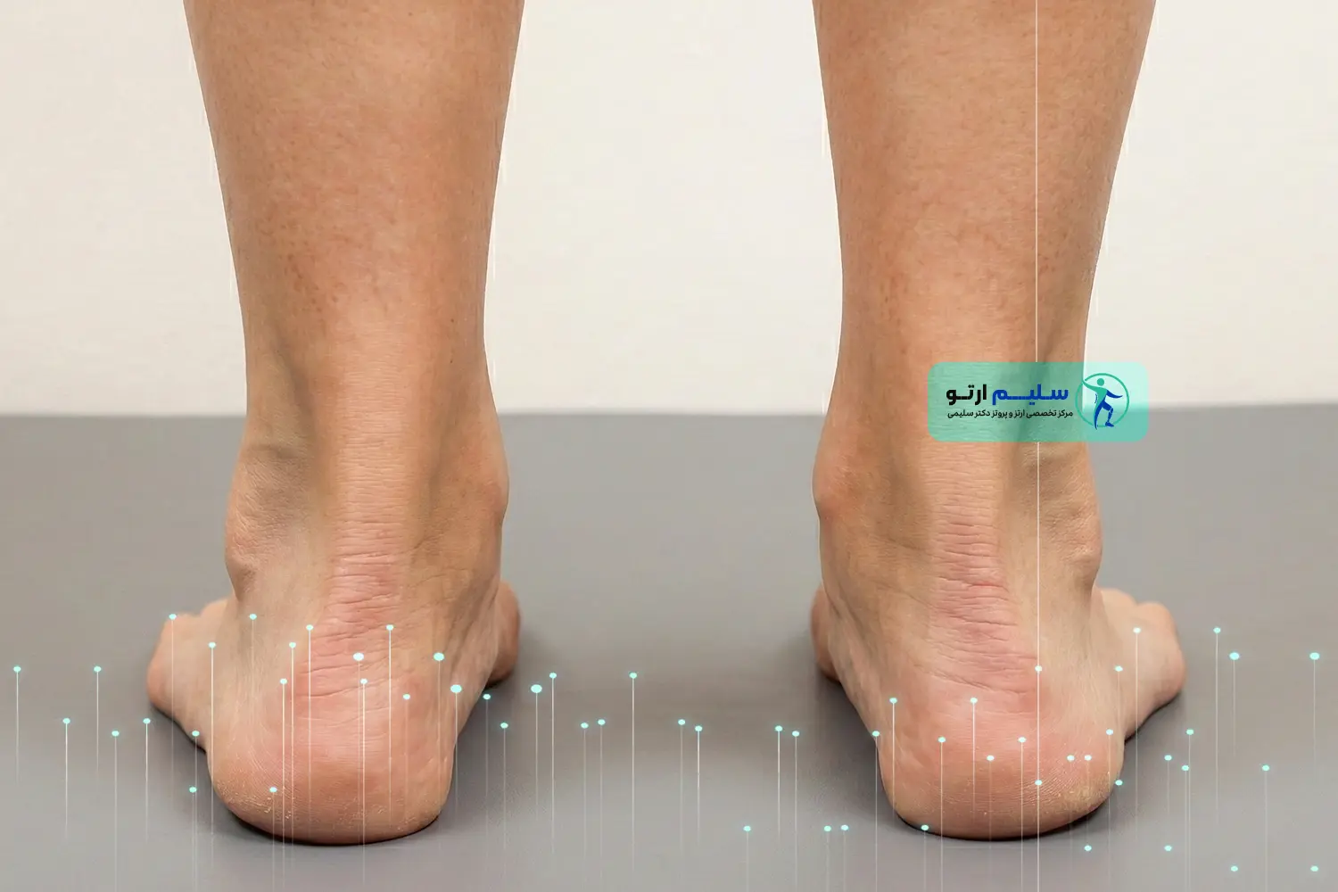 چرخش مچ پا به داخل چرخش مچ پا به داخل 2