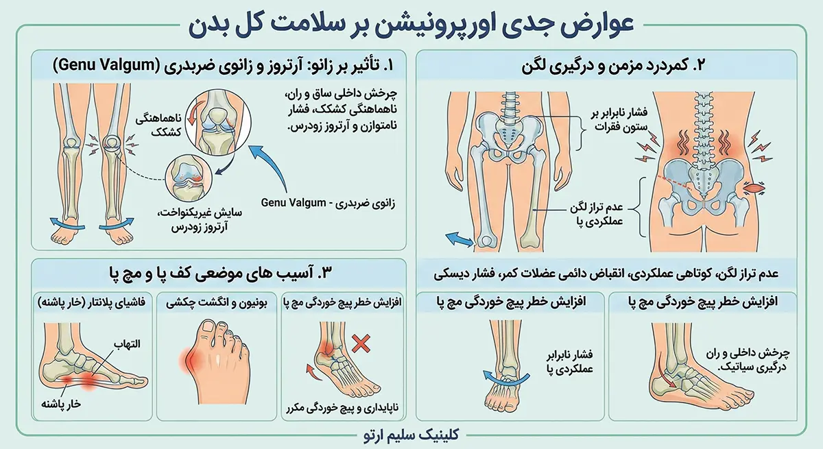 چرخش مچ پا به داخل عوارض جدی اورپرونیشن بر سلامت کل بدن