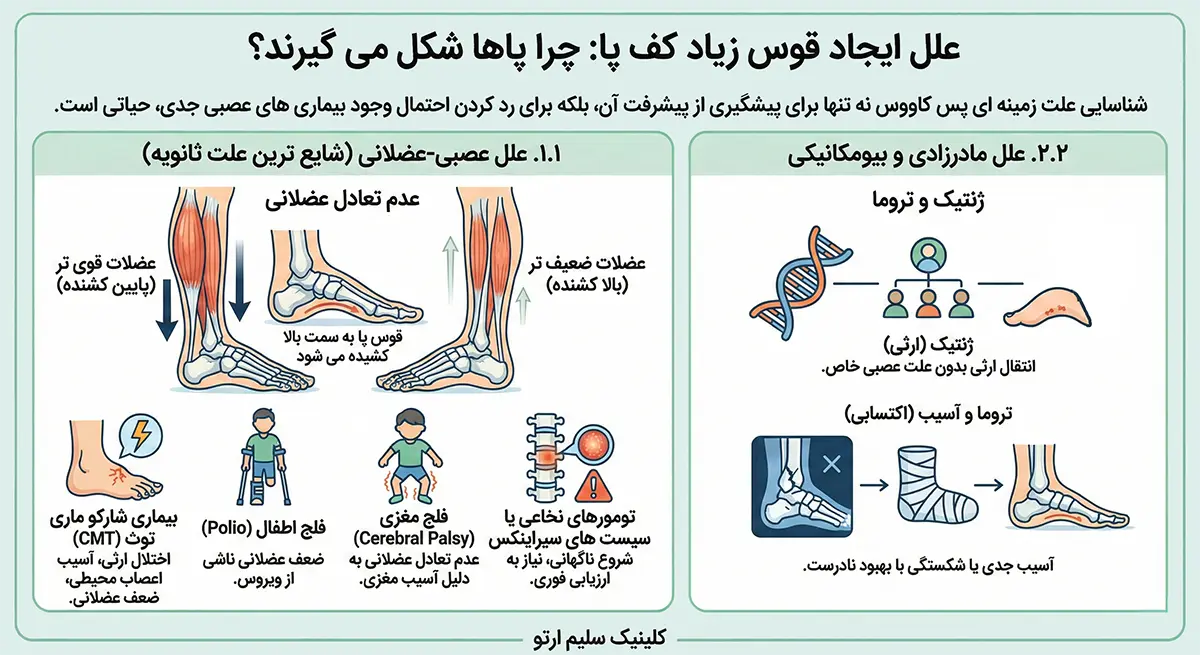 قوس زیاد کف پا علل ایجاد قوس زیاد کف پا: چرا پاها شکل می گیرند؟