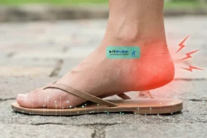 چرا صندل معمولی خار پاشنه را بدتر میکند؟